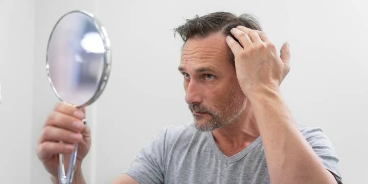 Los 3 tipos de caída del cabello y tratamientos que realmente funcionan, según dermatólogos