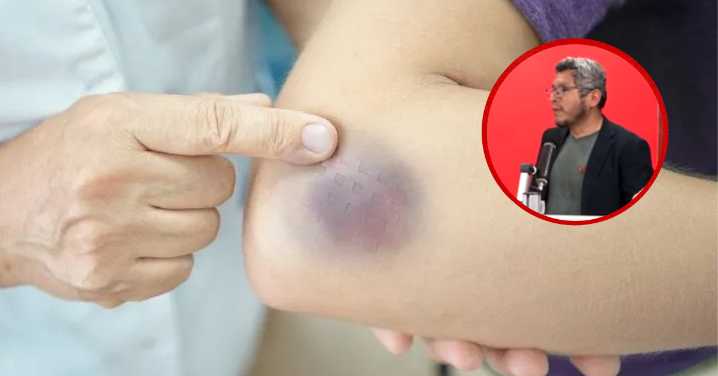 Crisis de salud: Alertan desabastecimiento de medicamento para más de mil pacientes con hemofilia