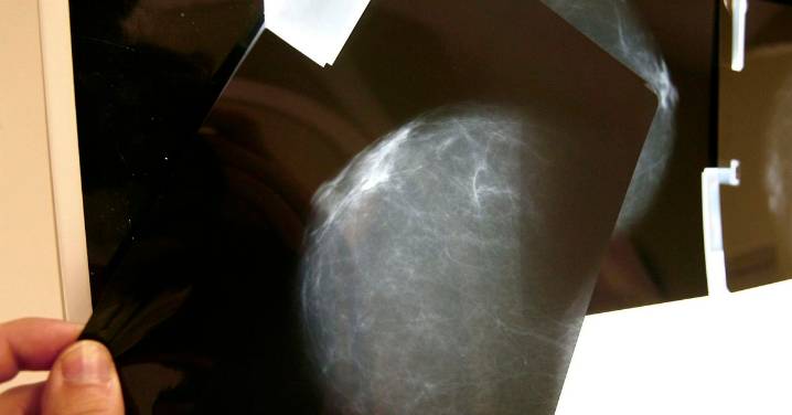 Amama tiene documentados 16 casos en Córdoba de pacientes con cáncer de mama afectadas por los fallos en los cribados