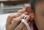 Tratamientos médicos y quirúrgicos, opciones en el IMSS para atender pacientes con diversos grados de sordera