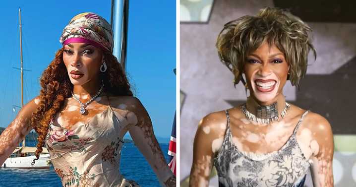 Winnie Harlow Breaks Silence After Massive Backlash Over ‘Disrespectful’ Whitney Houston Halloween Look