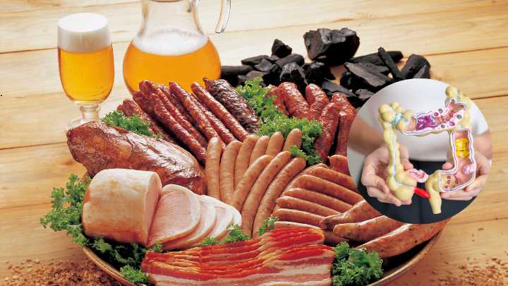 After Lancet Links Ultra-Processed Foods to Organ Damage, New Study Ties Them to Bowel Polyps in Women Under 50