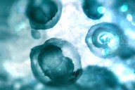 4 out of 5 Americans have concerns with embryonic screening, study finds