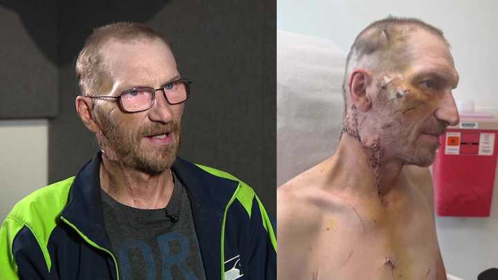 WA DoorDash driver recounts after vicious attack