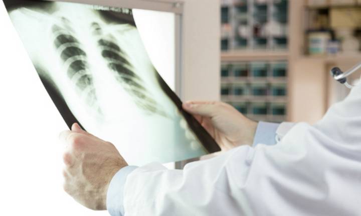 Ante los cambios de clima, piden tomar los recaudos necesarios para prevenir los cuadros de neumonía