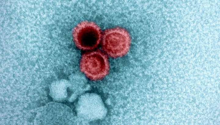 Mystery Of How Epstein-Barr Virus Causes Lupus Finally Solved