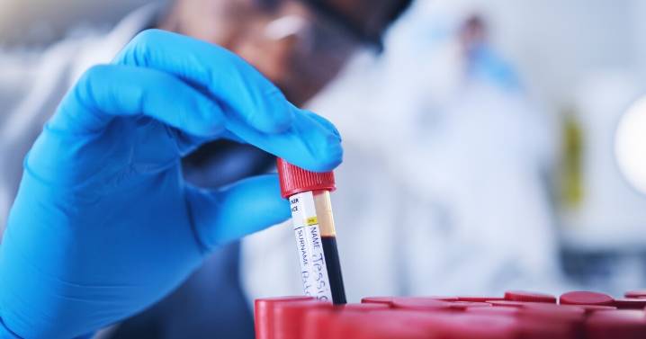 UVM researchers identify blood tests that could predict dementia risk