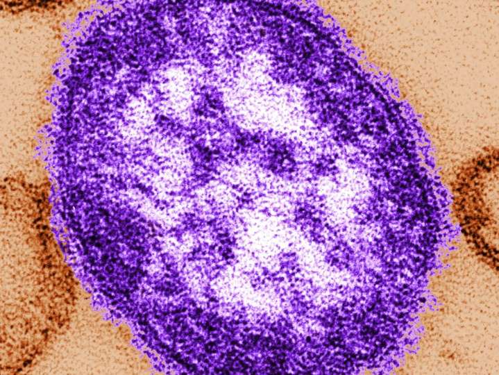 26 measles cases reported in B.C. in 1 week