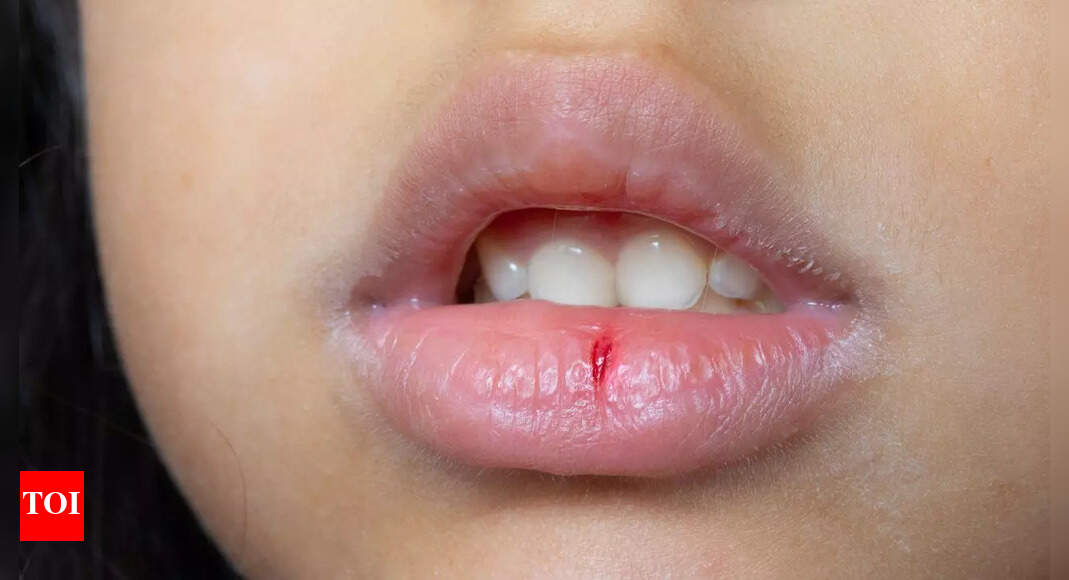 What your lips say about your health: 6 warning signs and health risks to watch