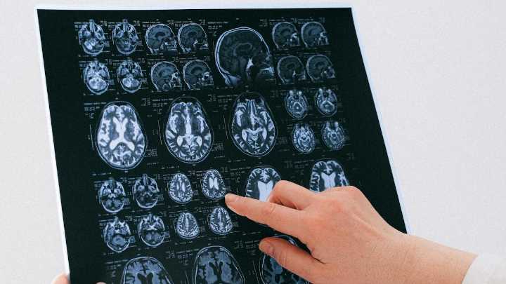 Las cinco etapas del cerebro humano: estudio revela cambios clave a los 9, 32, 66 y 83 años