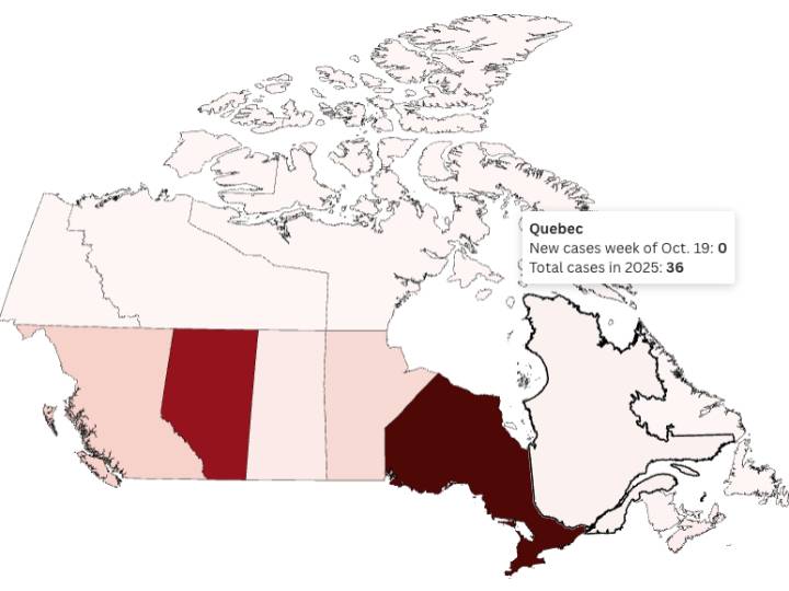 Canada lost its measles-free status. What's the situation in Quebec?