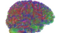 Descubren que el cerebro pasa por cinco fases a medida que envejecemos y estas son las cuatro edades clave