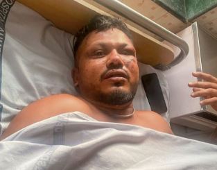 Air India crash survivor seeks welfare aid to cope with trauma