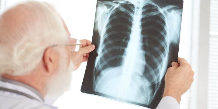 Día Mundial de la Neumonía: cuáles son los síntomas de la infección respiratoria más letal del mundo