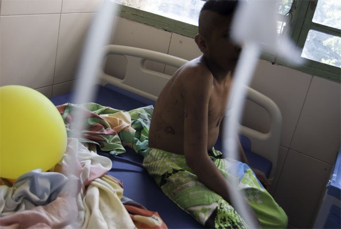 Cáritas alerta sobre la desnutrición infantil y actos de La Chinita llaman a la paz