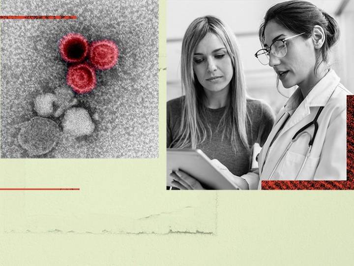 Could the Epstein-Barr virus be the culprit behind lupus?