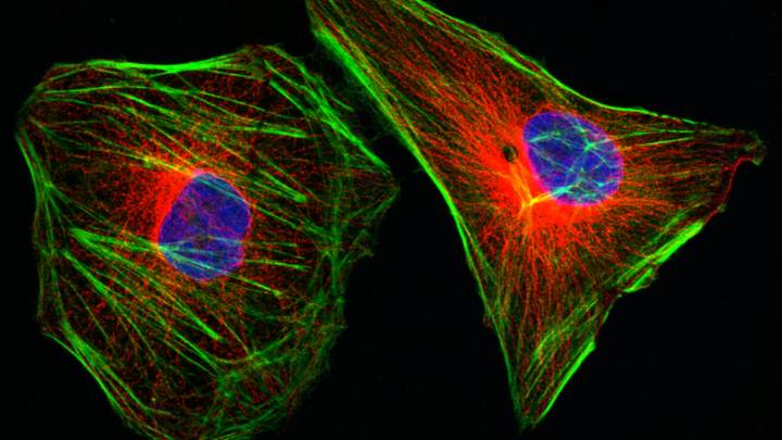 Cervical cancer, HPV shot, lorazepam: Morning Rounds