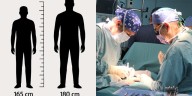 Peruanos están cansados de medir 165 cm en promedio: hombres se someten a costosa y dolorosa cirugía para ser más altos