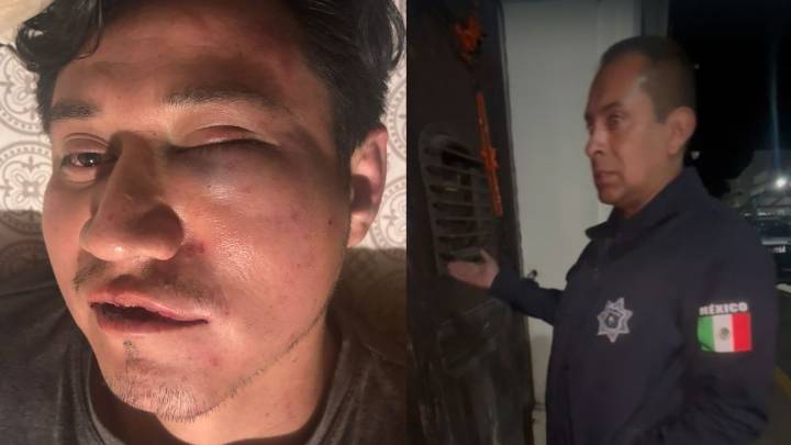 Policías de Ciudad Serdán irrumpen en una casa, golpean a joven y le fracturan las costillas; familia exige justicia