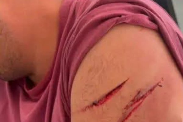 Brutal asalto en Corrientes: un joven apuñalado, casa destruída en búsqueda de dólares y ladrones prófugos