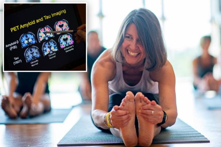 Alzheimer's risk declines sharply with one daily lifestyle change, researchers say