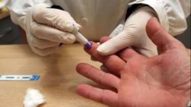 Sífilis, la ITS que crece en San Juan: qué es, cómo se contagia y sus síntomas