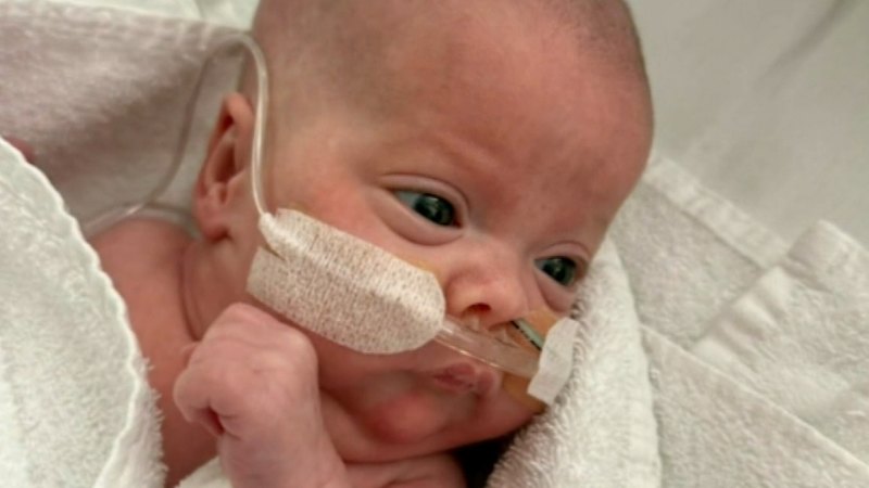 Australia’s youngest-ever premature baby