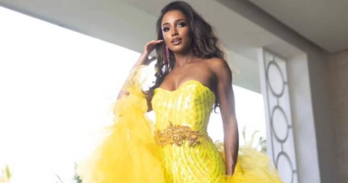 Miss Jamaica está en cuidados intensivos tras caída: ‘No está tan bien como esperábamos’