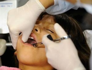 Countries agree to end mercury tooth fillings by 2034