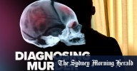 Shaken baby syndrome: Listen to Diagnosing Murder podcast Episode 4