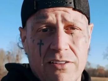 Country star Jelly Roll reveals new look