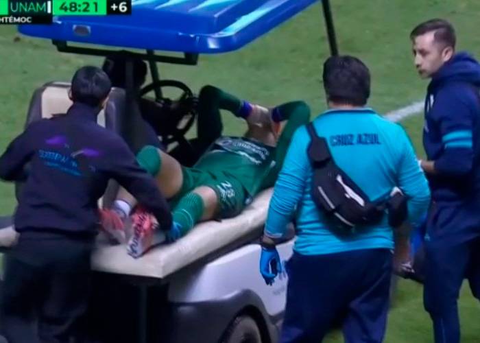 Kevin Mier, sufrió fractura de tibia en la pierna derecha