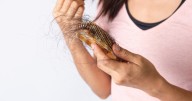 Women experience hair loss too. Here's what can help