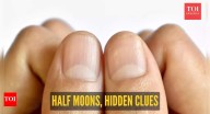 From kidney disease to heart health: What our nail’s half moon says about our health and when to worry