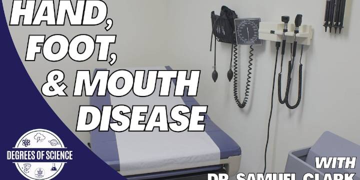 Degrees of Science: Hand, Foot, & Mouth Disease