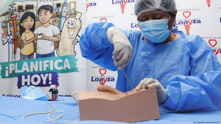 Minsa inicia campaña de vasectomías gratuitas en 73 hospitales: conoce dónde y cómo acceder