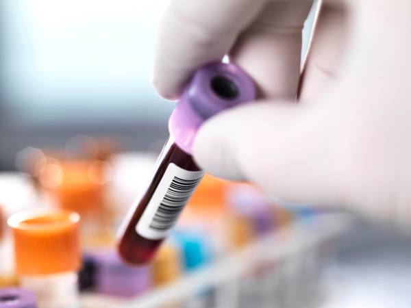 CRISPR shows promise in lowering high cholesterol