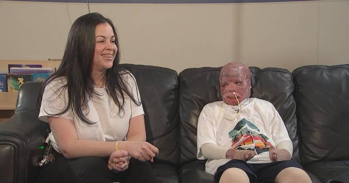 10-year-old burned in Philadelphia plane crash closer to coming home after almost 1 year of treatment: "He's strong."