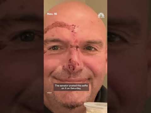 Sen. Fetterman at home after cardiac episode and fall