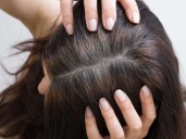 Decisión de Anmat.  Estos son los productos médicos y capilares que fueron prohibidos