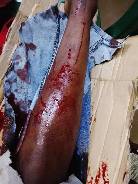 Secondary School Teacher Hospitalized After Being Attacked By Thugs In Dowa