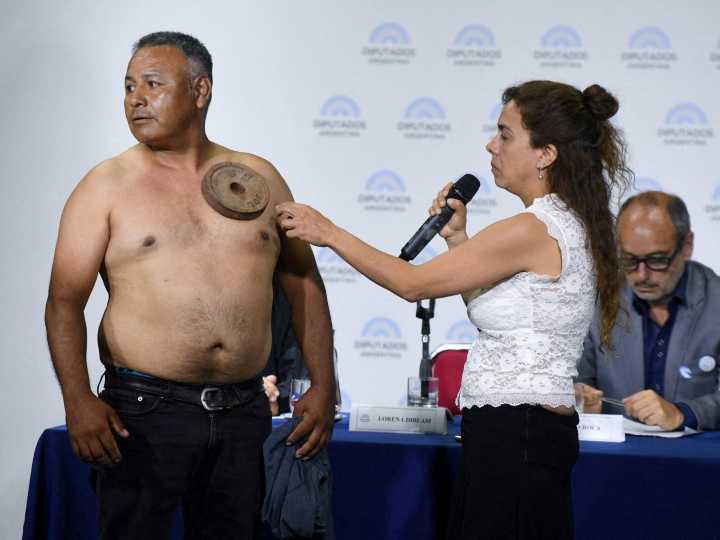 La "magnetización" postulada por una diputada del PRO y el riesgoso relato antivacunas en el Congreso