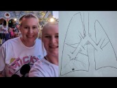 Broken limb leads to non-smoker's lung cancer diagnosis years later