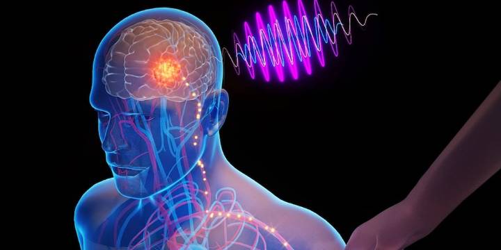 Chips inyectables autoimplantables ofrecen esperanza para trastornos cerebrales