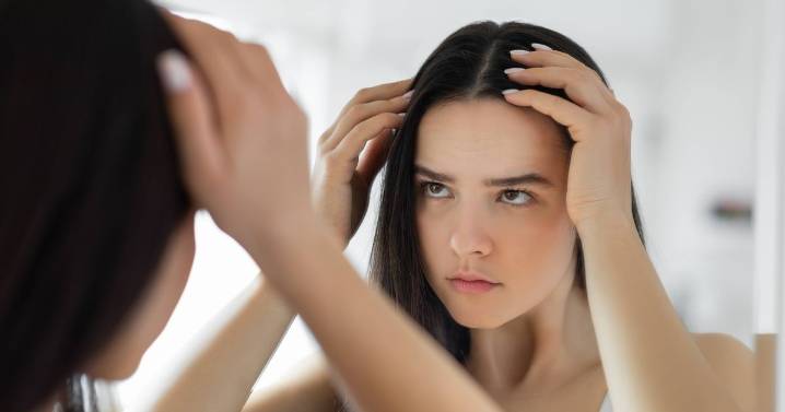 Women urged to demand two GP tests if they notice their hair thinning