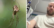 A spider bite in the UK left me on a drip in hospital 
