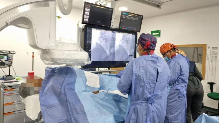 Salva IMSS Chihuahua vida de paciente, con primera trombectomía pulmonar endovascular en el estado