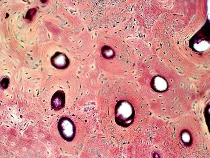 Científicos rusos crean aplicación para diagnóstico osteocondrosis