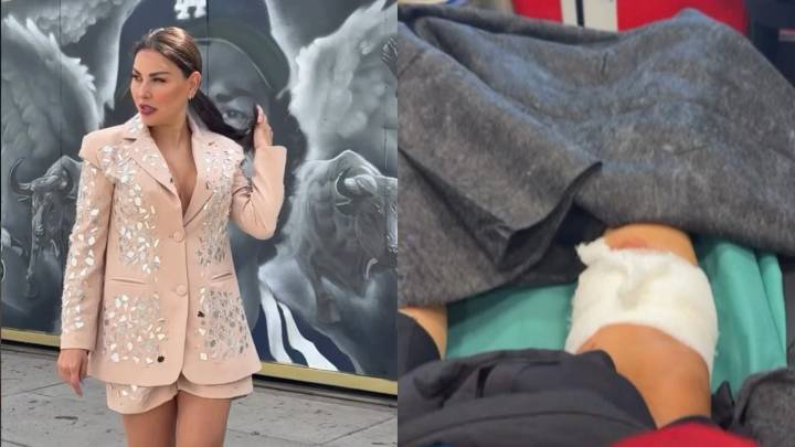 Gaby Ramírez, conductora de TV, sufre ataque de peligroso animal; fue hospitalizada de urgencia