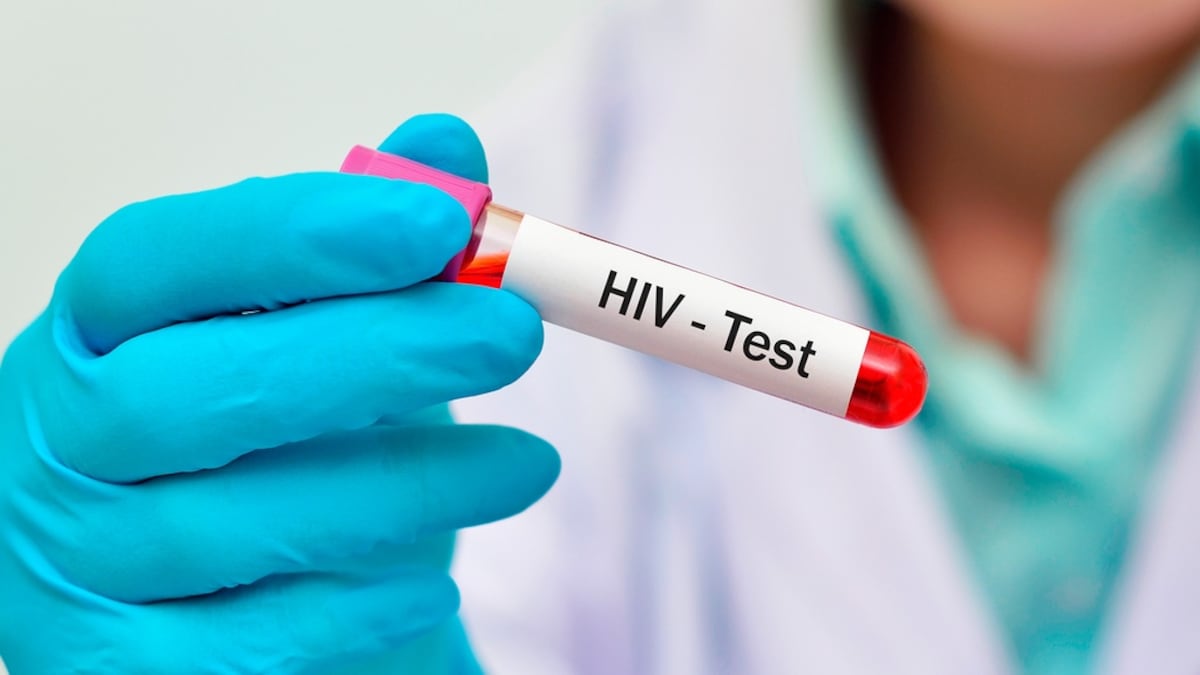 Instituto de la Juventud Ecatepec realizará Jornada de Salud para la detección del VIH